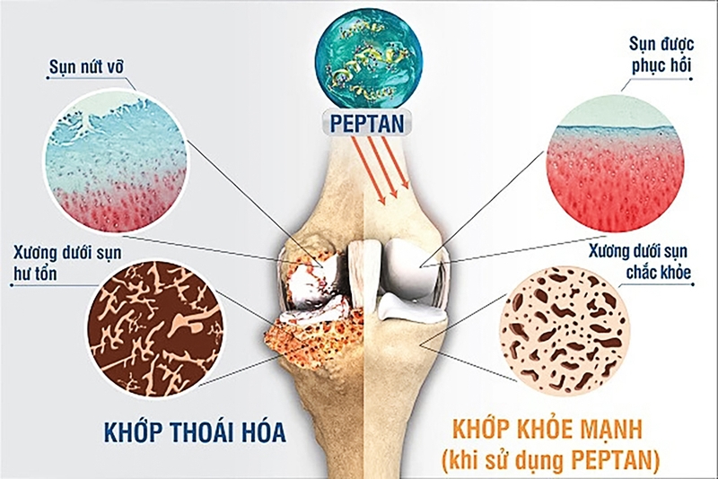 Peptan là gì? Tác dụng của dưỡng chất này đối với xương khớp 2
