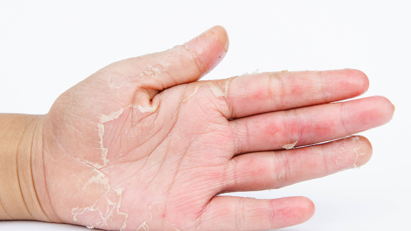 pha-che-dung-dich-rua-tay-tai-nha-nhu-the-nao 4