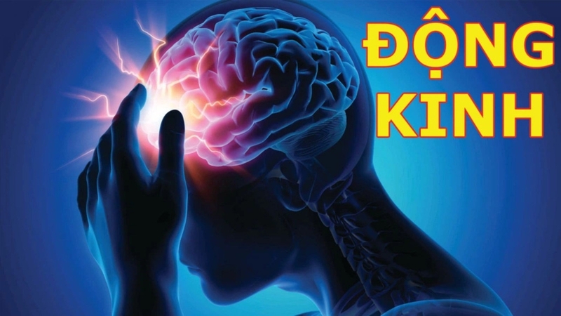 Phác đồ điều trị động kinh và nguyên tắc điều trị bệnh động kinh 1