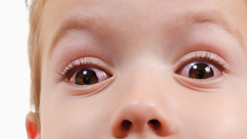 Phác đồ điều trị lậu mới nhất của Bộ Y tế 2