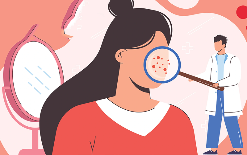 Phác đồ điều trị mụn chuẩn y khoa được Bác sĩ da liễu sử dụng-4