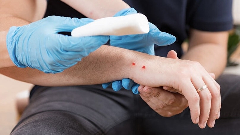 phac-do-dieu-tri-ran-can-bo-y-te-chia-khoa-bao-ve-suc-khoe-cong-dong 3