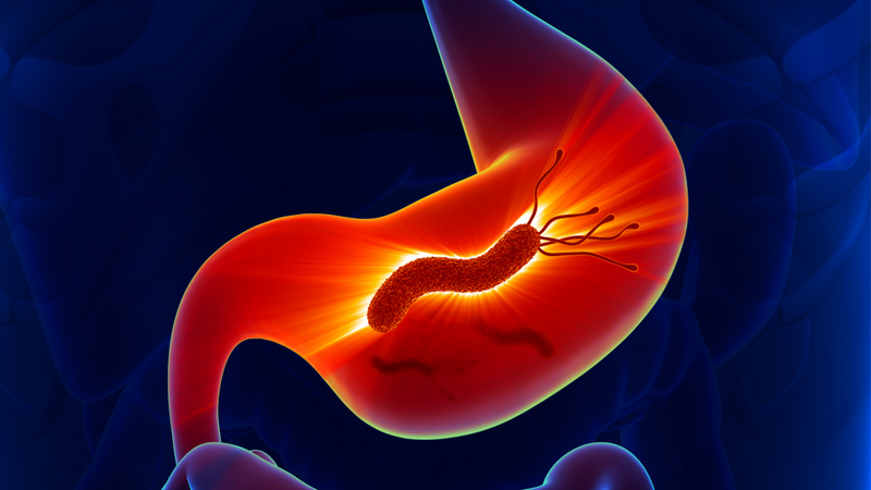 Phác đồ điều trị vi khuẩn HP dạ dày như thế nào?1