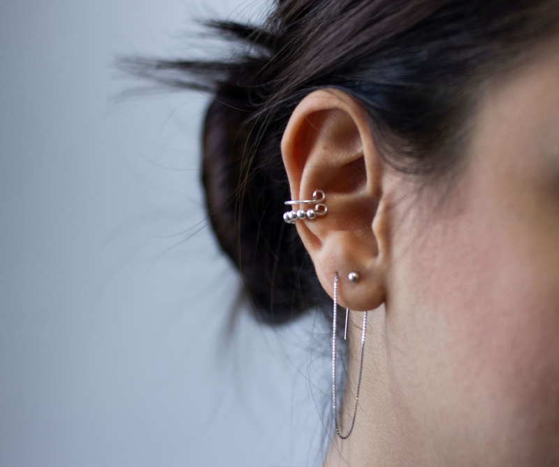 Phác đồ điều trị viêm sụn vành tai hiệu quả là như thế nào? 1