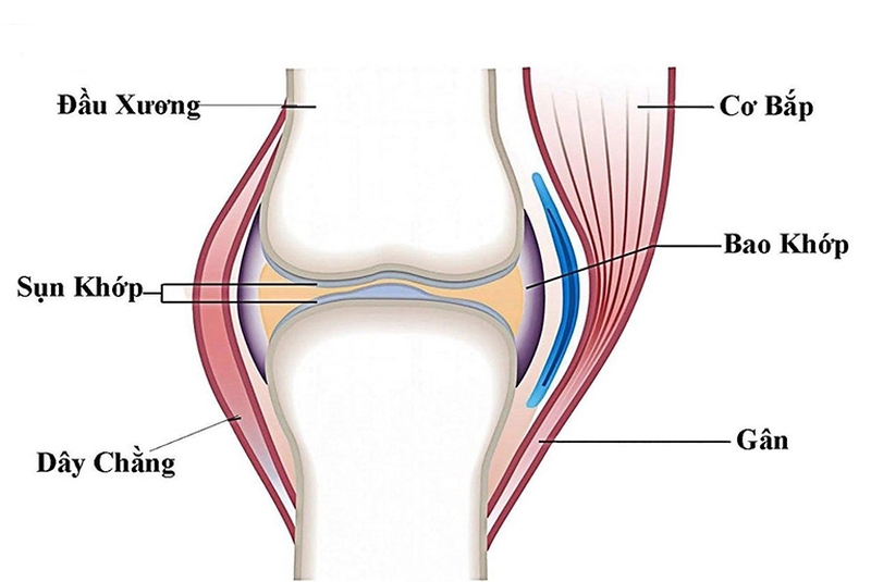 Phải làm gì khi bị bong gân giãn dây chằng? 1