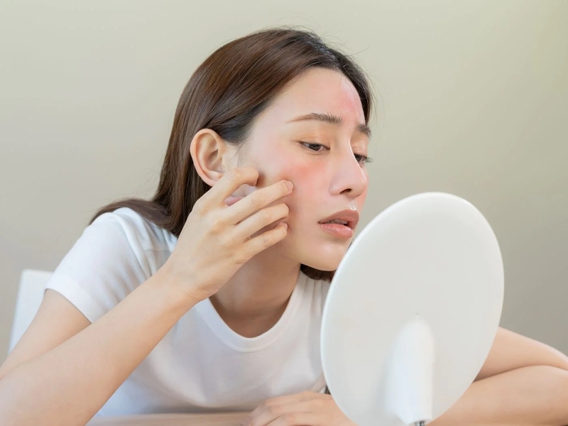 Phân biệt da khô và da mất nước - Hướng dẫn cách khắc phục 2