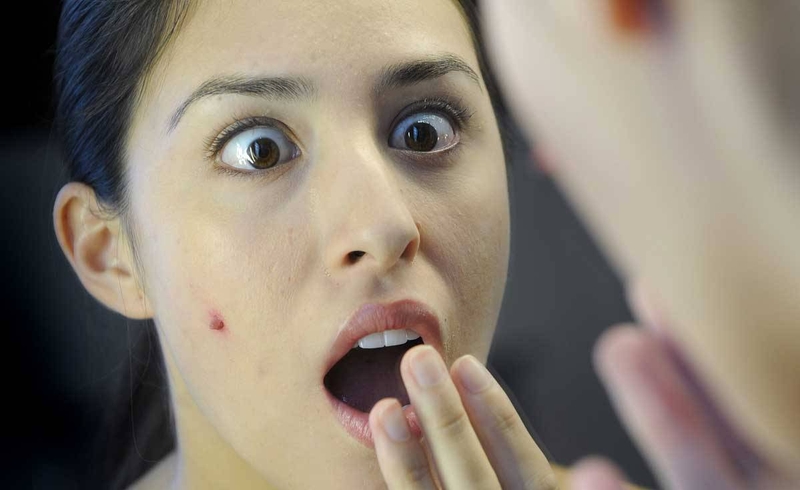 Phân biệt hai bệnh thủy đậu và đậu mùa 1