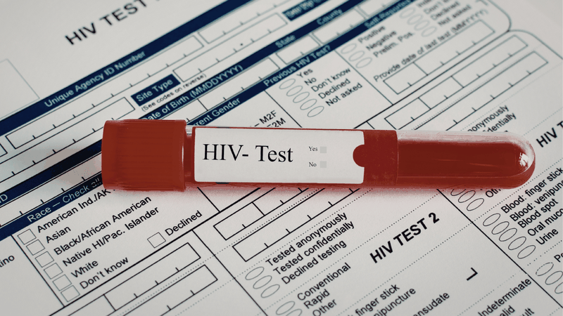 Nên thăm khám và trao đổi trực tiếp với bác sĩ trước khi sử dụng PrEP hoặc PEP để đảm bảo an toàn