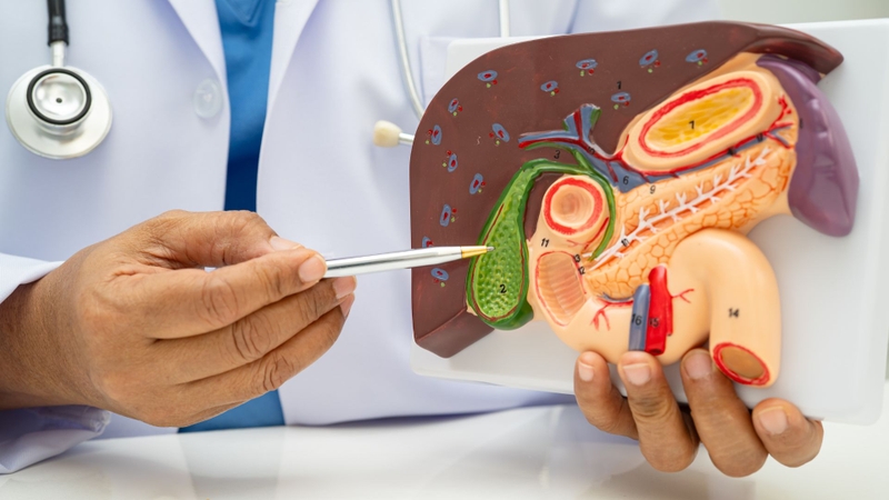 Phân biệt viêm ruột thừa và bệnh túi mật-2