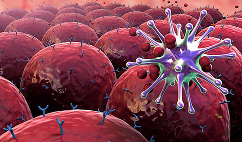 Phân độ mô khối u theo 5 mức độ