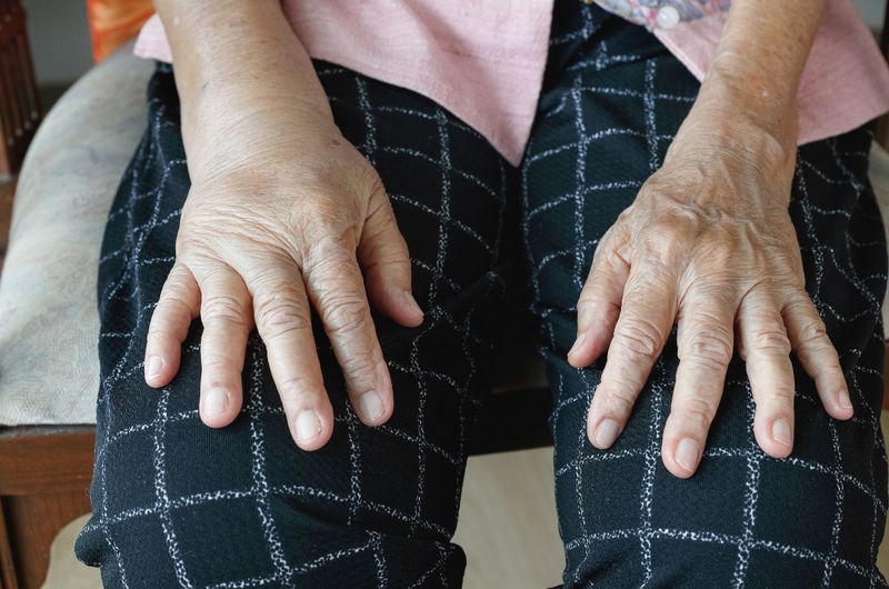 Tìm hiểu về các phân độ phù, nguyên nhân và cách điều trị 3