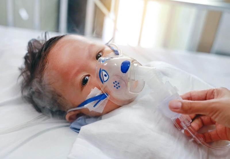 Phân độ suy hô hấp ở trẻ em: Triệu chứng và cách điều trị 1