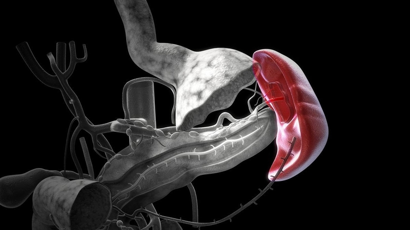 Phân độ vỡ lách và các triệu chứng của vỡ lách 1