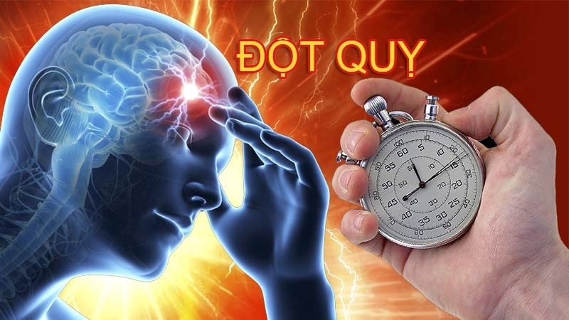 Phân loại và nhận diện triệu chứng đột quỵ: Hướng dẫn cần thiết cho mọi người 3
