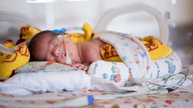 Phân su trẻ sơ sinh là gì? Có những bệnh lý phân su nào? 3