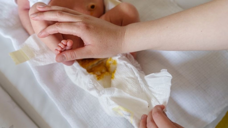 Phân trẻ bú sữa công thức có gì khác so với bình thường? 2