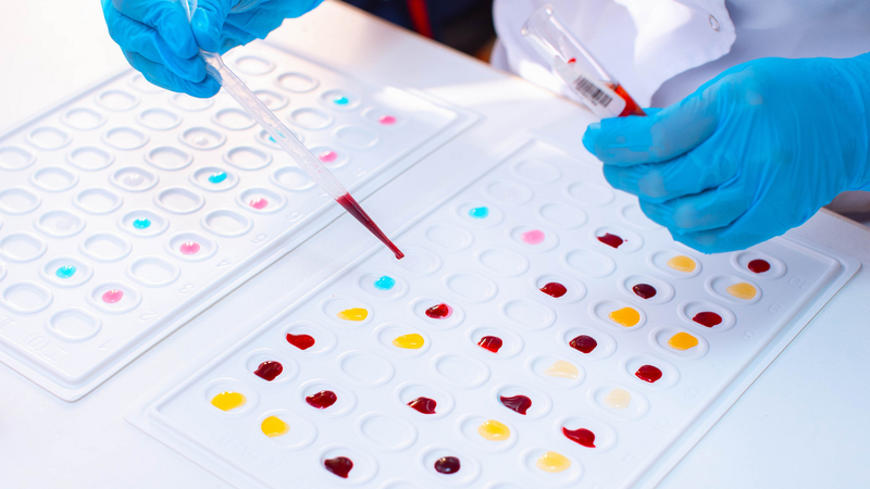 Phản ứng hòa hợp trong truyền máu có ý nghĩa như thế nào? 1