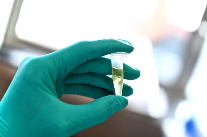 Phản ứng Pandy là gì? Quy trình thực hiện xét nghiệm phản ứng Pandy đúng chuẩn 4