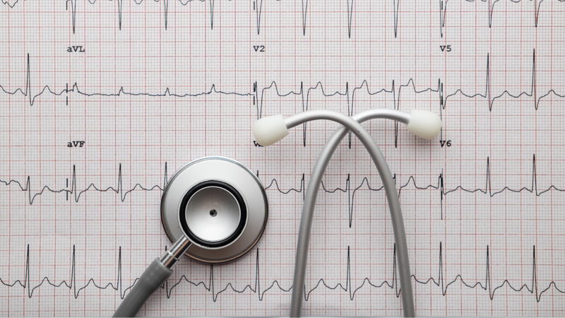 phan-xa-marey-la-gi-ung-dung-cua-phan-xa-marey-trong-y-hoc 2