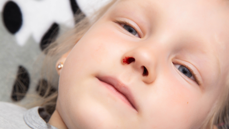 Phát ban sốt xuất huyết: Dấu hiệu nhận biết và cách phòng ngừa 5