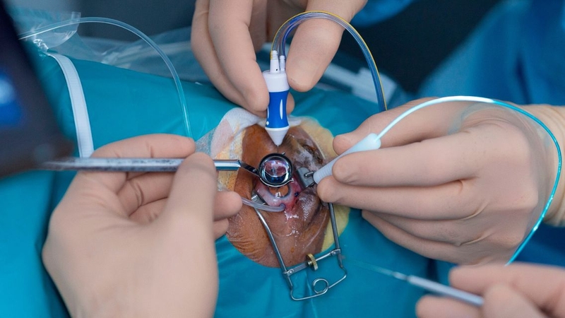Bác sĩ thăm khám và đánh giá tình trạng võng mạc trước điều trị