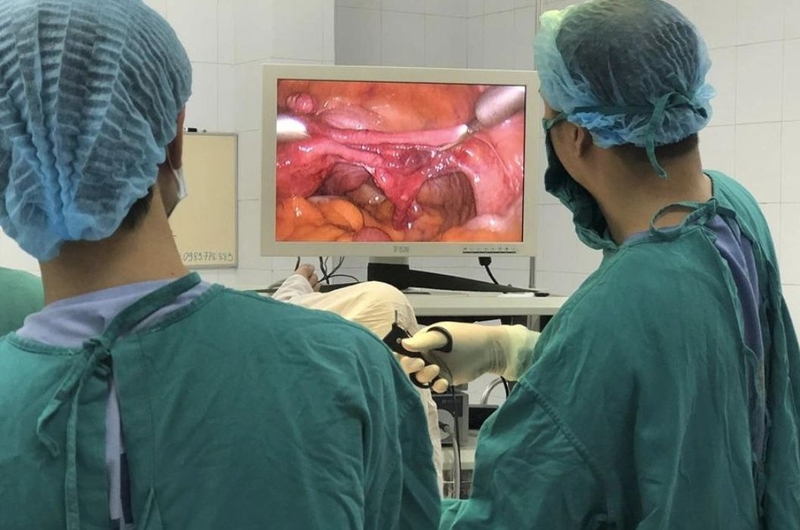 Tìm hiểu chi tiết về phẫu thuật cắt tử cung 2