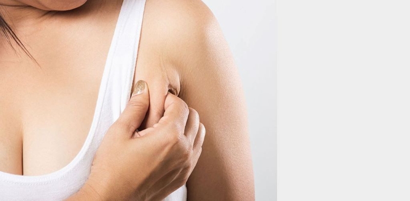 Phẫu thuật cắt tuyến vú phụ: Mục đích, đối tượng chỉ định và quy trình thực hiện phẫu thuật 2