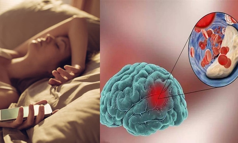 Phẫu thuật dị dạng mạch máu não và cách chăm sóc sau phẫu thuật 2