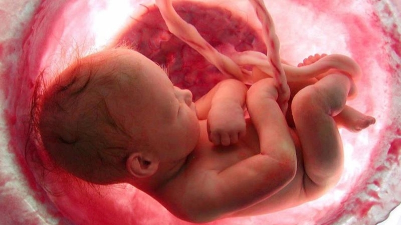 Phẫu thuật kênh nhĩ thất toàn phần: Giải pháp cho bệnh lý tim bẩm sinh nguy hiểm 1