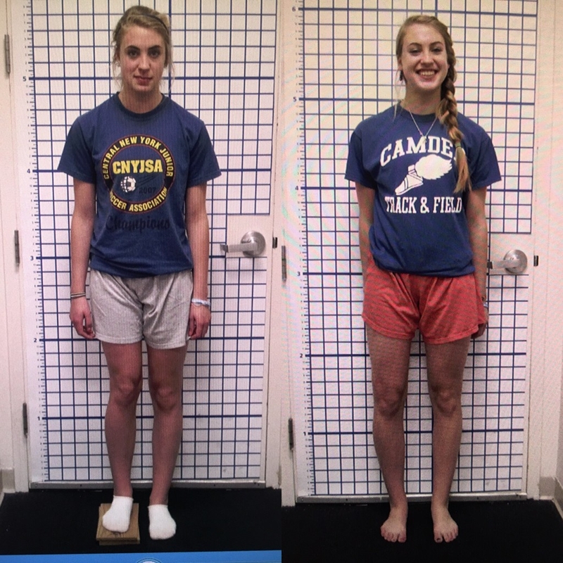 Phẫu thuật kéo dài chân: Đôi chân dài không còn là mơ ước nữa 2