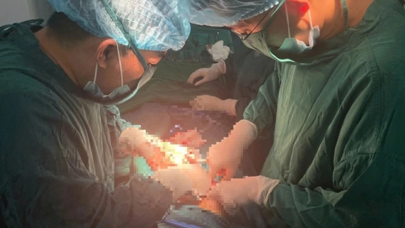 Các bác sĩ tiến hành phẫu thuật cho sản phụ bị u nang buồng trứng biến chứng xoắn hoại tử