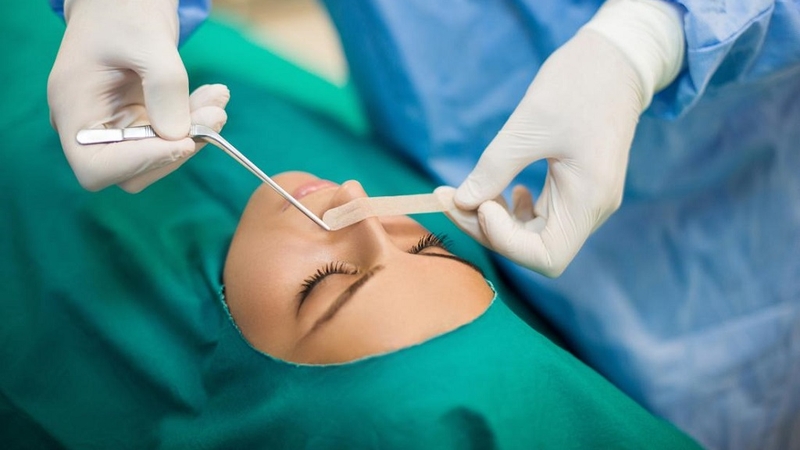 Phẫu thuật lệch vách ngăn mũi: Chỉ định và quy trình thực hiện 1