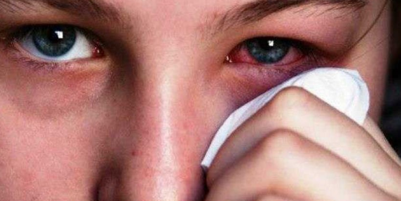 Phẫu thuật lông mi quặm có tốt thật sự như lời đồn? 3