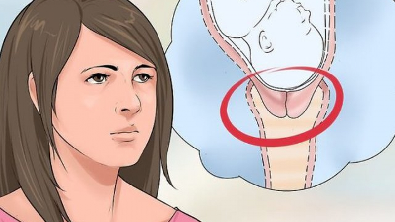 phau-thuat-manchester-dieu-tri-sa-sinh-duc-duoc-thuc-hien-nhu-the-nao 1.jpg