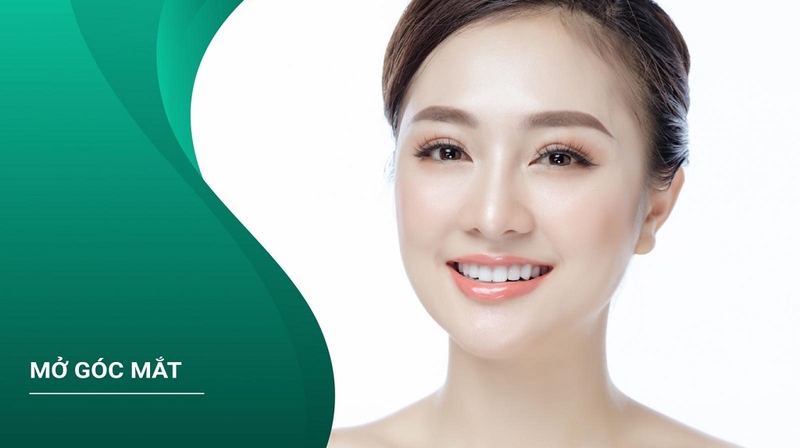 Phẫu thuật mở góc mắt: Các thông tin cần biết 1