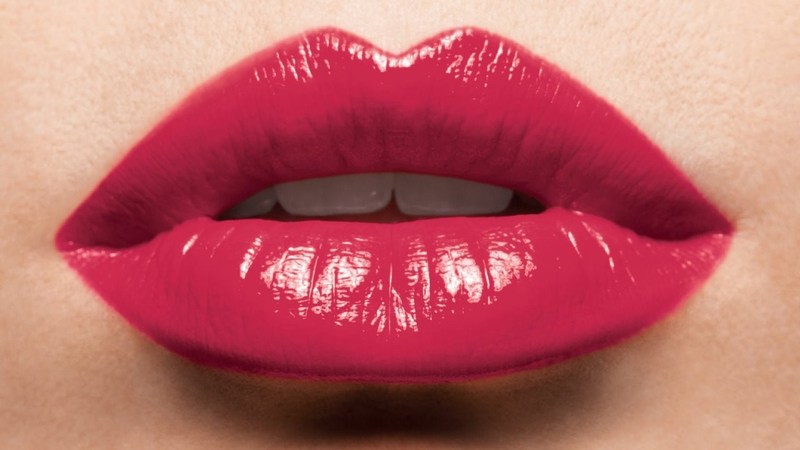 Phẫu thuật môi dày thành mỏng như thế nào? 1