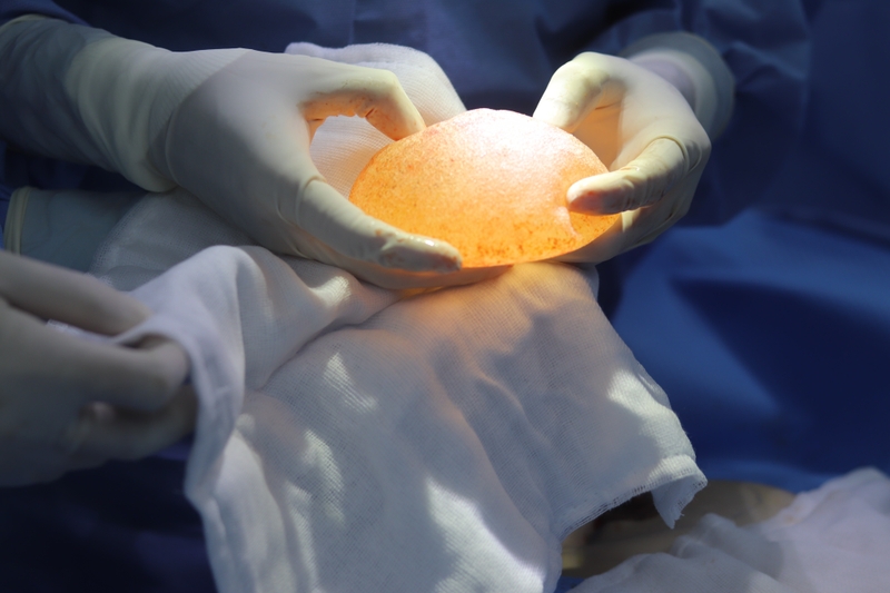 Phẫu thuật nâng ngực bao nhiêu tiền? Những ai nên phẫu thuật nâng ngực? 2