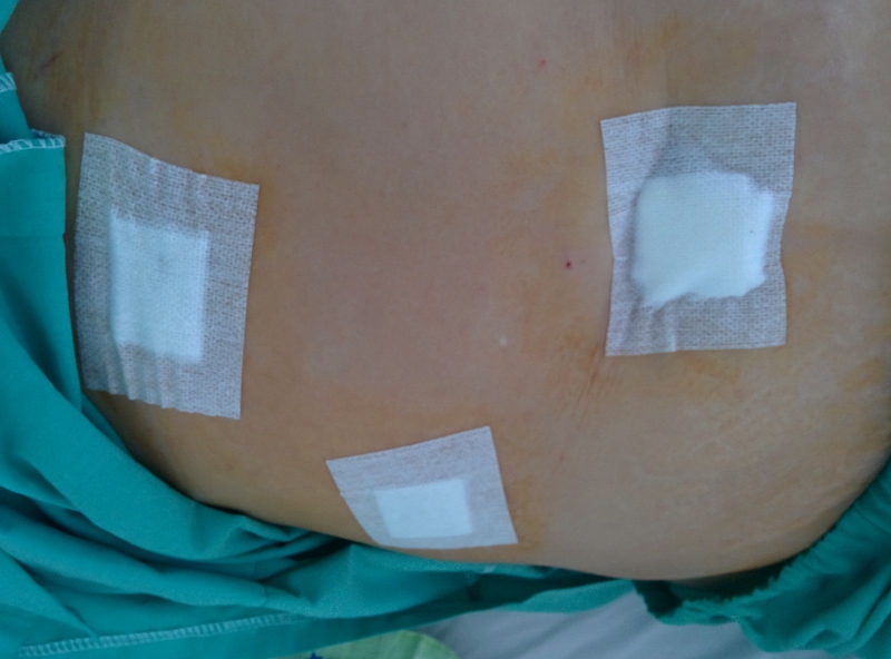 Phẫu thuật nội soi điều trị những bệnh gì? 3