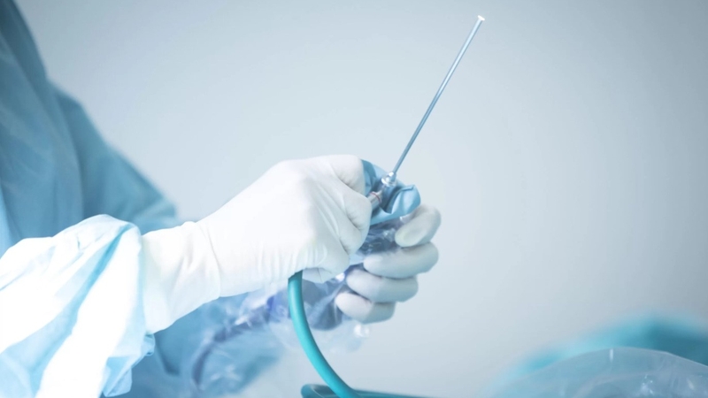 Phẫu thuật nội soi khớp vai là gì? Ưu điểm khi nội soi khớp vai 2