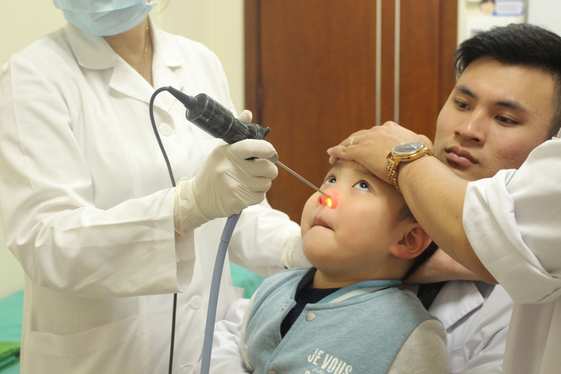 Phẫu thuật polyp mũi - nên hay không 1