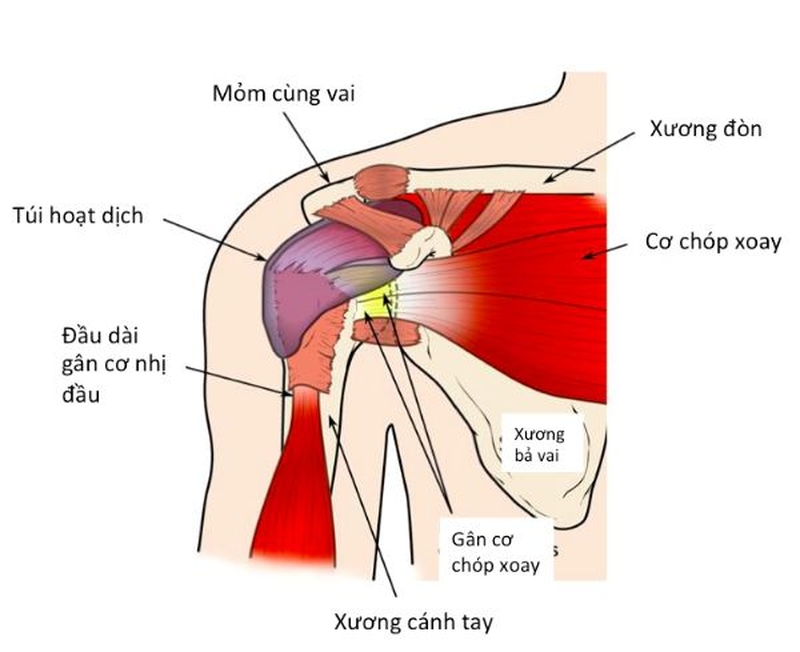 Phẫu thuật trật khớp xương cùng đòn