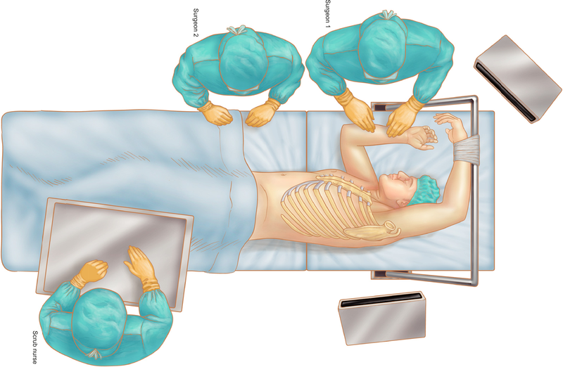 Phẫu thuật trung thất qua nội soi lồng ngực 3