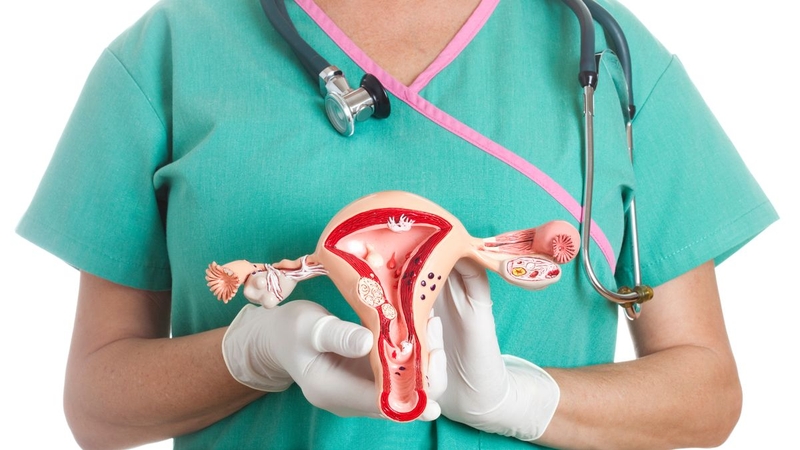 Phẫu thuật u nang buồng trứng và những điều cần biết 5