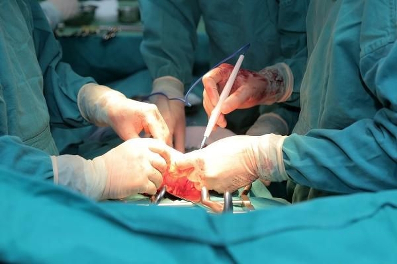 Chế độ dinh dưỡng sau phẫu thuật ung thư dạ dày1