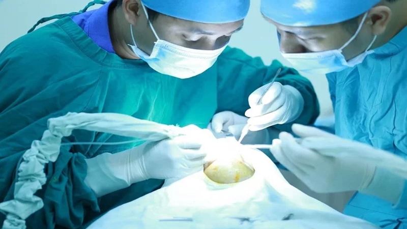 Phẫu thuật vẩu hàm trên là gì? Quy trình phẫu thuật 4