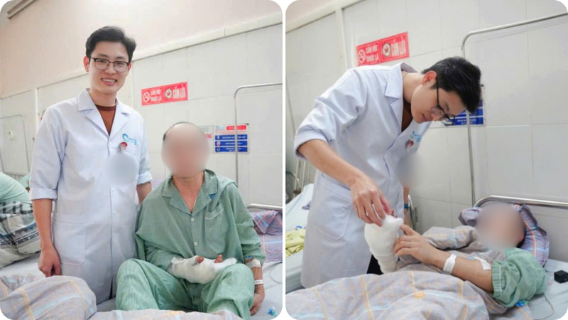 Chấn thương bàn tay chiếm tỷ lệ lớn trong các tai nạn lao động và tai nạn sinh hoạt