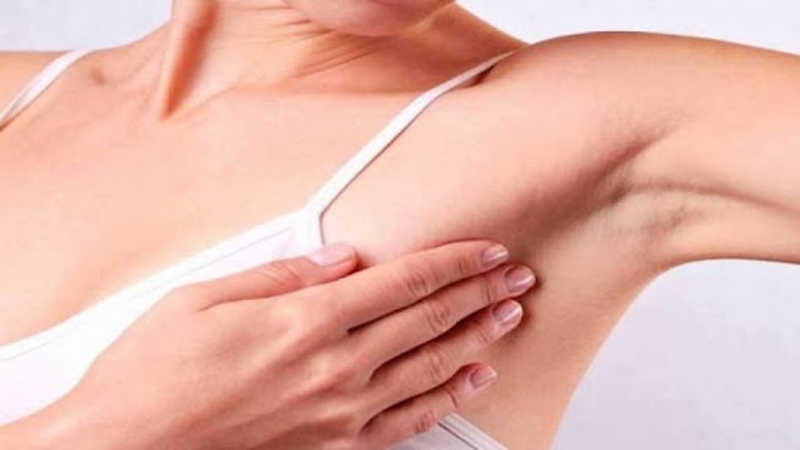 Phẫu thuật vú 2