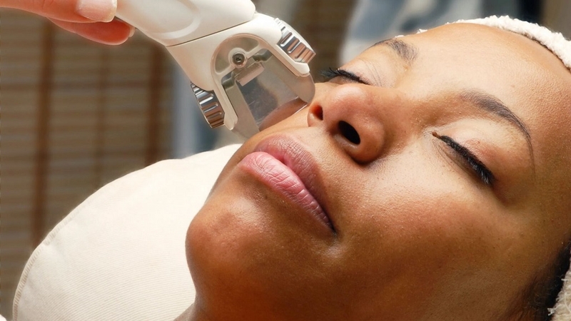 Phẫu thuật xóa sẹo trắng: Ưu điểm và lưu ý 3