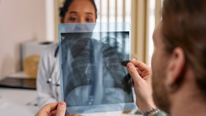 Giãn phế nang do nhiều nguyên nhân khác nhau gây ra