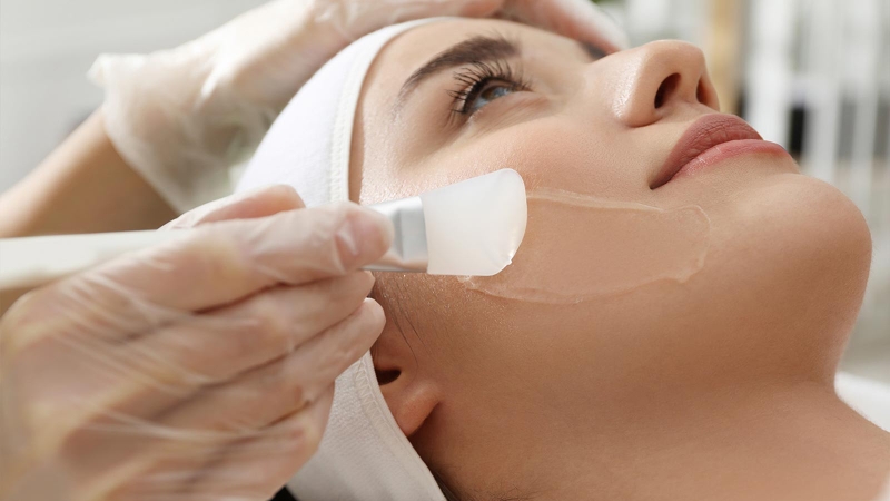 Phenol peel là gì? Công dụng và một số điều cần lưu ý 3